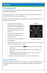 Preview for 15 page of ZOLL Cardiac Monitor User Manual