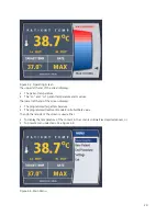 Preview for 37 page of ZOLL IVTM Operation Manual