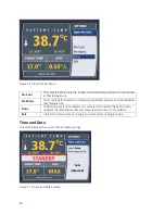 Preview for 44 page of ZOLL IVTM Operation Manual