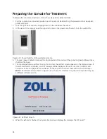 Предварительный просмотр 52 страницы ZOLL IVTM Operation Manual