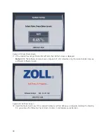 Preview for 56 page of ZOLL IVTM Operation Manual