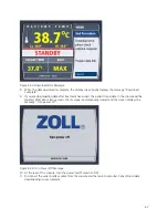 Preview for 75 page of ZOLL IVTM Operation Manual