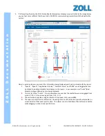 Preview for 81 page of ZOLL Road Safety RS-4000 System Overview And Installation