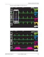 Preview for 73 page of ZOLL X Series Operator'S Manual