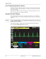 Preview for 84 page of ZOLL X Series Operator'S Manual
