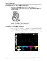 Предварительный просмотр 96 страницы ZOLL X Series Operator'S Manual