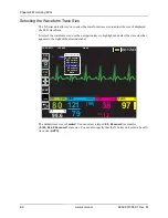 Preview for 98 page of ZOLL X Series Operator'S Manual