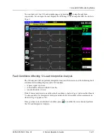 Предварительный просмотр 193 страницы ZOLL X Series Operator'S Manual