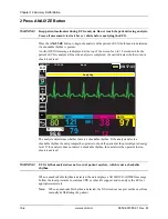 Предварительный просмотр 216 страницы ZOLL X Series Operator'S Manual