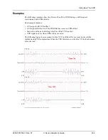 Предварительный просмотр 245 страницы ZOLL X Series Operator'S Manual