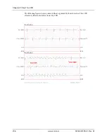 Предварительный просмотр 248 страницы ZOLL X Series Operator'S Manual