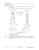 Preview for 38 page of ZOLL Z Vent Operator'S Manual