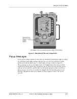 Preview for 81 page of ZOLL Z Vent Operator'S Manual